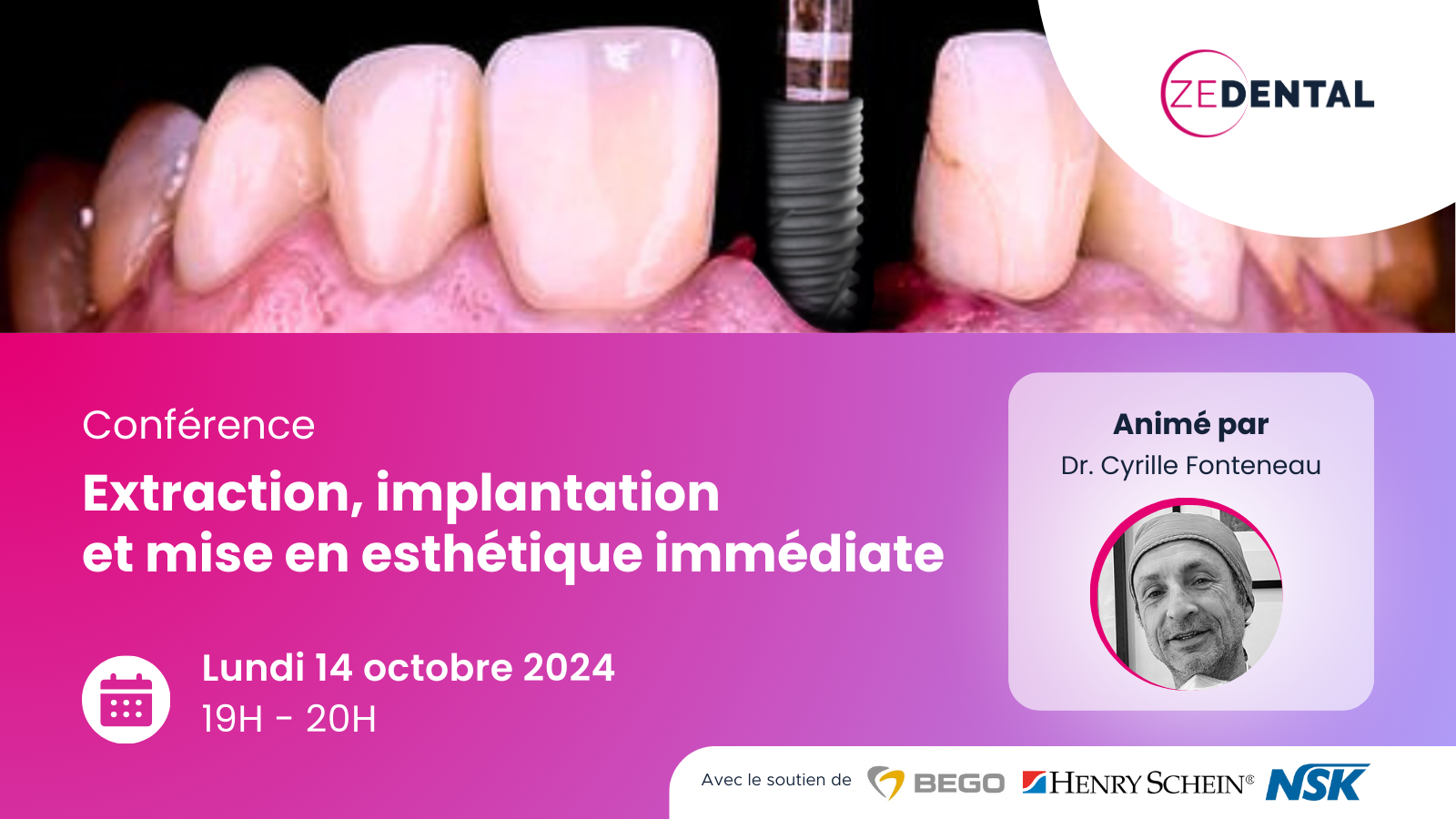 LandingPage - Webinar - Extraction, implantation et mise en esthétique _ logo-1