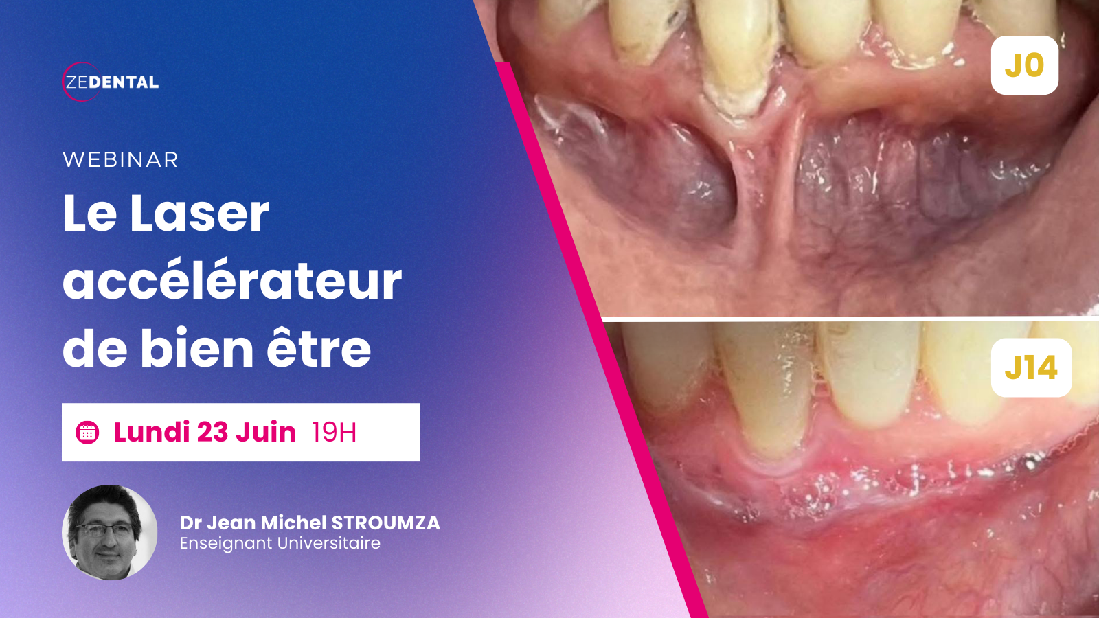 20250623 l Zedental l Conf | Laser accélérateur de bien-être - Dr Stroumza l Cover 20250623 l Zedental l Conf | Laser accélérateur de bien-être - Dr Stroumza l Cover